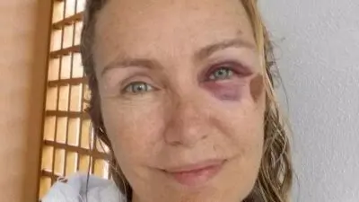 Licia Colò, che botta! “Felice di essere ancora con voi”