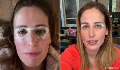 Clio MakeUp svela il risultato della blefaroplastica: ecco i suoi occhi senza punti Clio MakeUp svela il risultato della blefaroplastica: ecco i suoi occhi senza punti