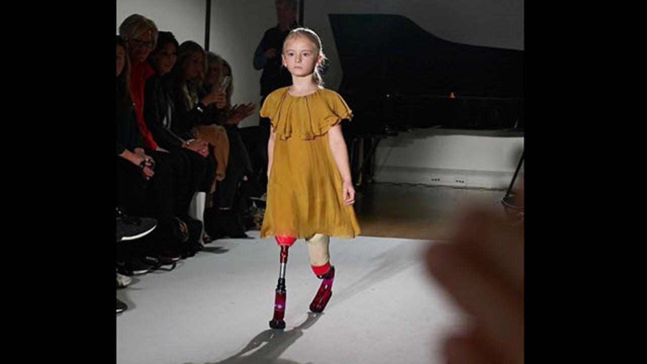 Daisy May, con le protesi alle gambe sale in passerella