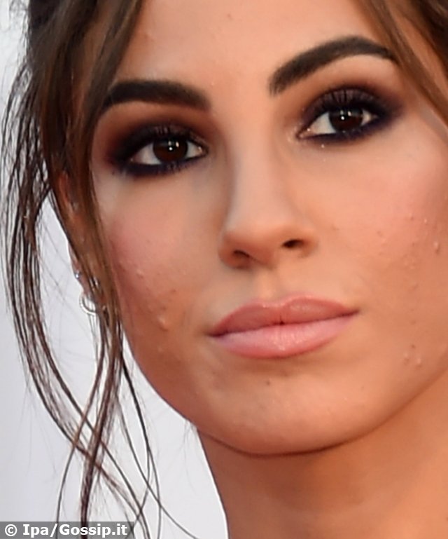 Giulia De Lellis con l’acne sul red carpet di Venezia: mostra le imperfezioni paladina dello ‘skin positive’