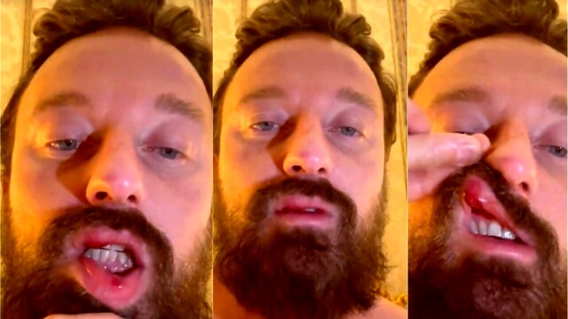 Francesco Facchinetti: “Non ritiro la denuncia a McGregor nemmeno se mi offrono 10 milioni”