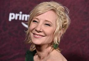 Anne Heche, rivelate le cause della sua morte