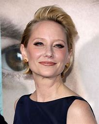 L’attrice Anne Heche in condizioni critiche dopo un incidente