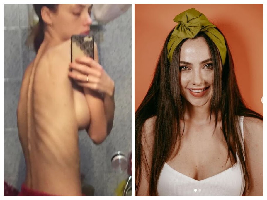 Rosalinda Cannavò e la lotta contro i disturbi alimentari : “Non potrò mai dimenticare quei momenti in cui mi sentivo inutile”